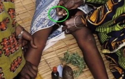 实拍非洲女孩割礼惨绝人寰全过程 被割去阴蒂阴唇保处女身