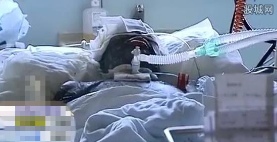 性感少妇直销员被泼硫酸 惨遭毁容丰满的胸部都烧黑了