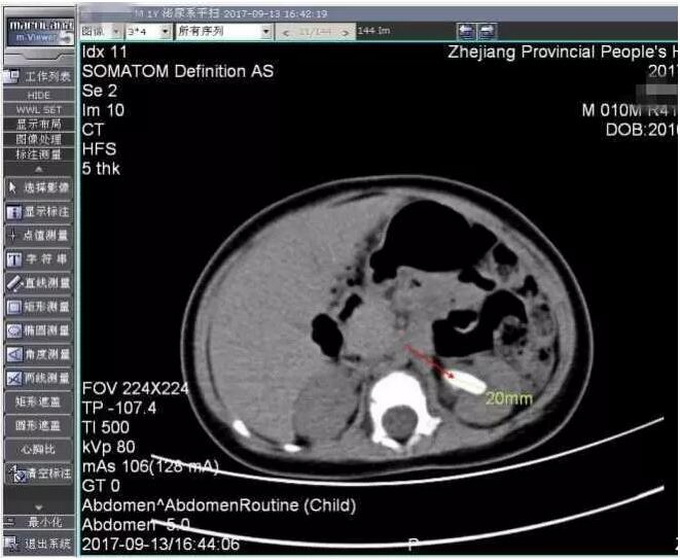 周五起北京公交启动冬运时刻 高峰快车加开26