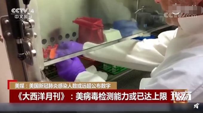 「推荐」美国新冠检测阳性率达20% 美媒：感染人数或远超公布数字