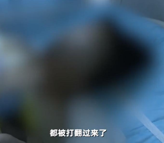 推荐深圳一居民在家中被雷电击中烧伤，伤者女儿：雷雨天一道白光闪入家中