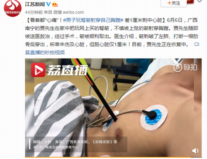 射箭男子玩弩箭刺破自己左肺穿透身体，差1厘米就伤及心脏