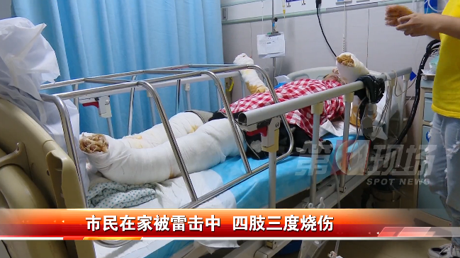 惊雷！女子在家中被雷击倒，四肢烧伤严重，女儿：我妈很善良
