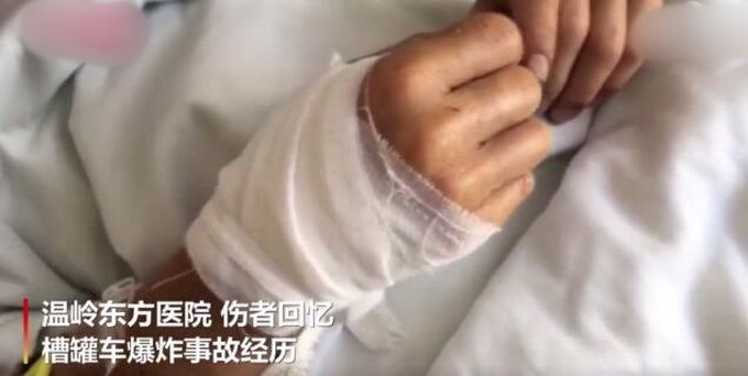 推荐温岭槽罐车爆炸致19人死亡，爆炸事故伤者回忆：我背上有个洞