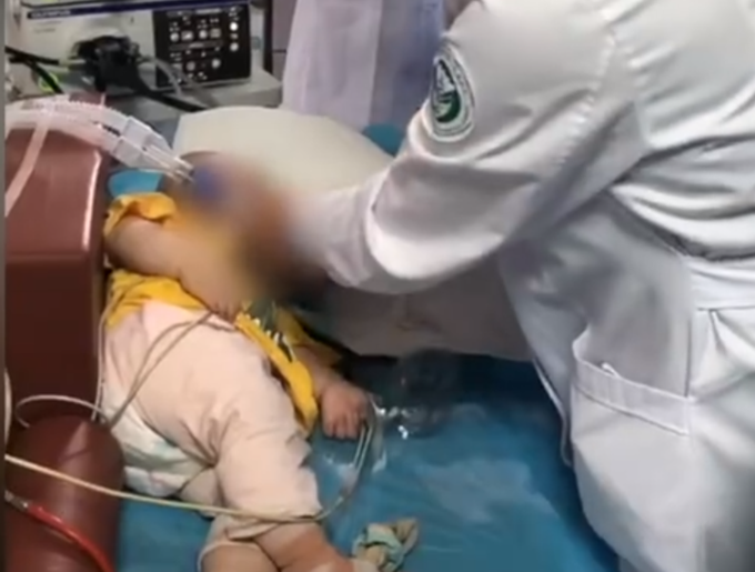 热点太危险！10个月大婴儿误食3厘米长别针，医生5分钟取出