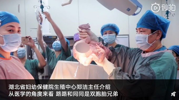 湖北一双胞胎兄弟相差10岁，网友：还有这种神奇的操作