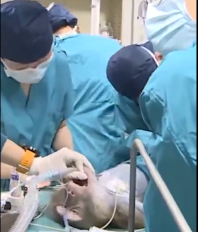 器官移植猪肝移植给猴子已存活16天，未来猪的器官或可移植给人体