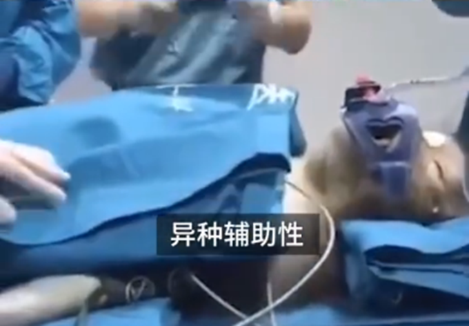 器官移植猪肝移植给猴子已存活16天，未来猪的器官或可移植给人体