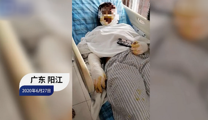 推荐女合伙人遭幼儿园长泼硫酸，警方通报：两人曾是情侣，全力追缉犯罪嫌疑人