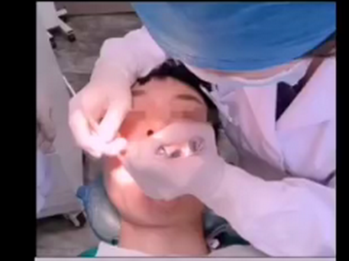 小伙拔牙10天后脑出血死亡，医生称血液里全是细菌