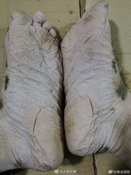|心疼！消防员救援后起皱发白的脚上热搜，网友：第一眼都不相信这是脚