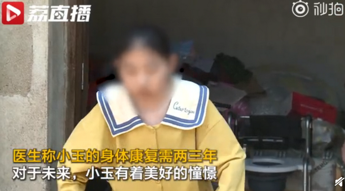 热点|4次手术，折叠女孩终能直立行走！网友：她是不幸的，也是幸运的