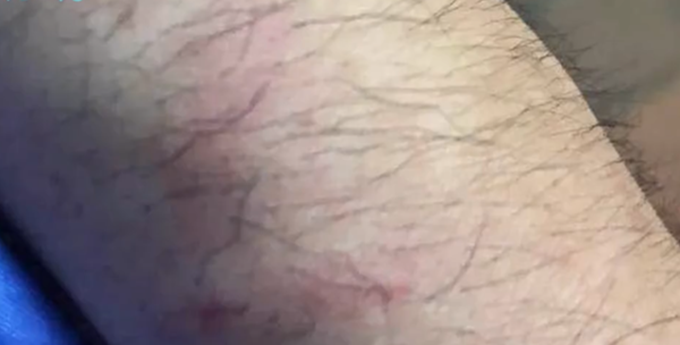 宠物|女子带狗乘公交被拒后咬伤民警，网友：乍一看还以为是狗咬的