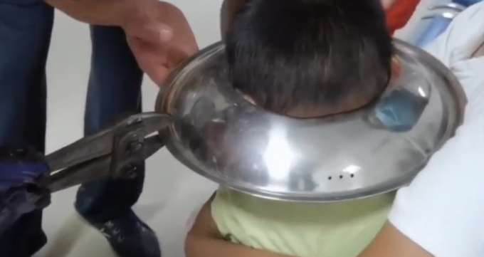 熊孩子|男孩脑袋卡进锅盖取不下来，网友：很心疼，但忍不住笑了