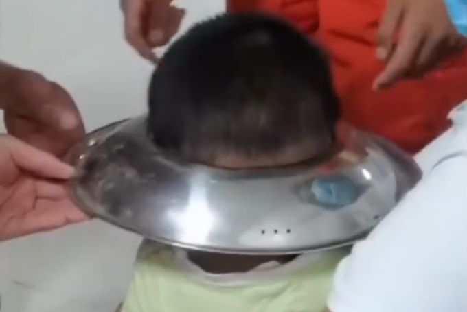 熊孩子|男孩脑袋卡进锅盖取不下来，网友：很心疼，但忍不住笑了