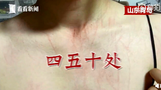 热点|青岛一女子买猫当天被抓五十道伤口，宠物店：管不了