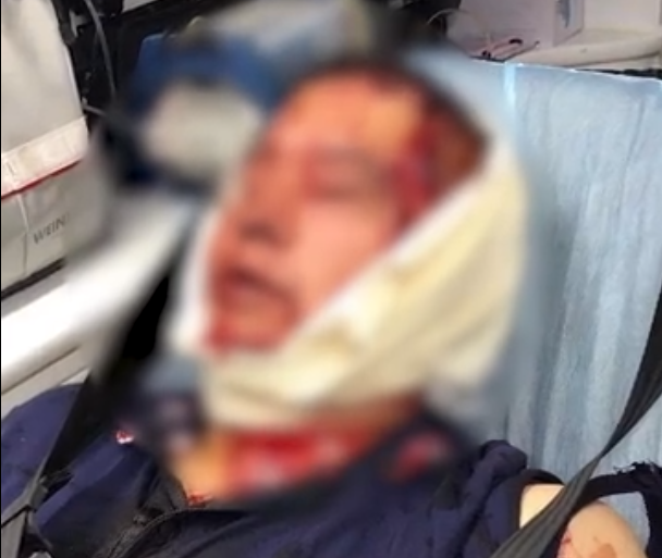 打架|上海两小学生打闹引发爸爸约架，一人头破血流，大人也跟着胡闹？