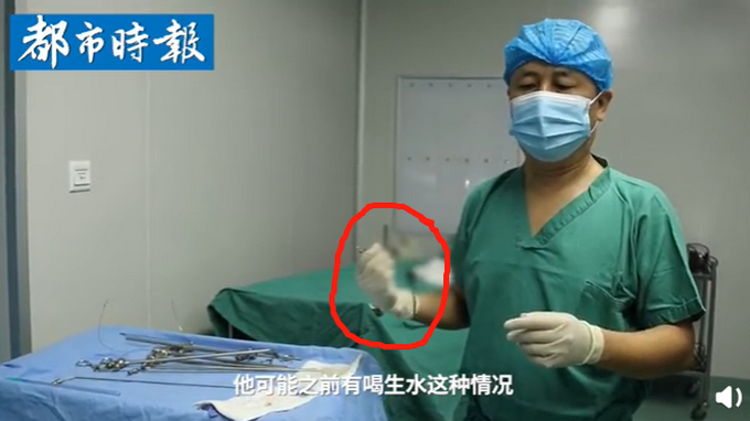 |别喝生水！活体蚂蟥在5岁男孩体内存留1年多，网友直呼可怕