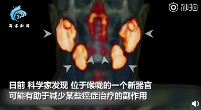 |科学家发现人类新器官，对于癌症治疗非常重要，影像曝光