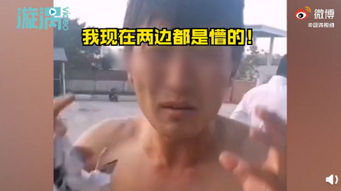 |男子开车捅蜂窝被蛰40多下，直呼头痛：脑袋两边都是懵的！