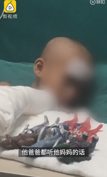 |被父亲烧伤男孩发声：爸爸妈妈一起床就打我，想与爷爷奶奶住