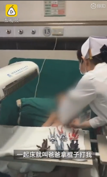 |被父亲烧伤男孩发声：爸爸妈妈一起床就打我，想与爷爷奶奶住