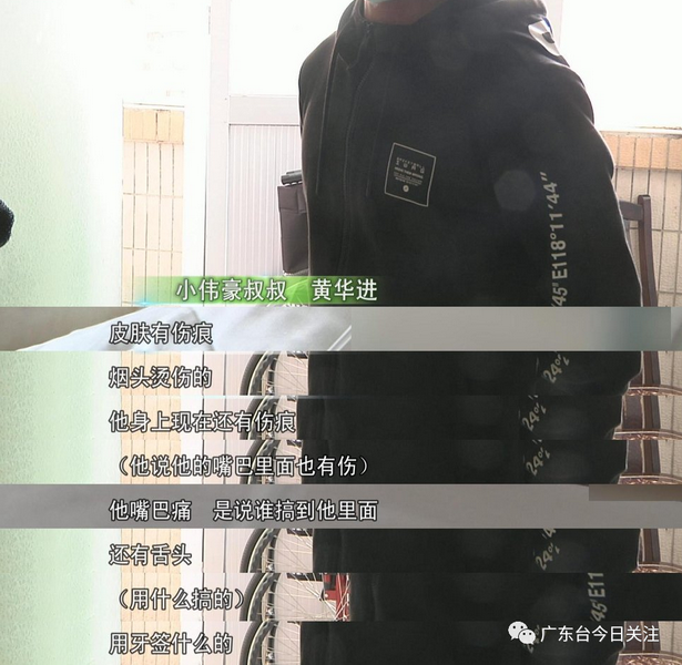 |被父亲烧伤男孩发声：爸爸妈妈一起床就打我，想与爷爷奶奶住